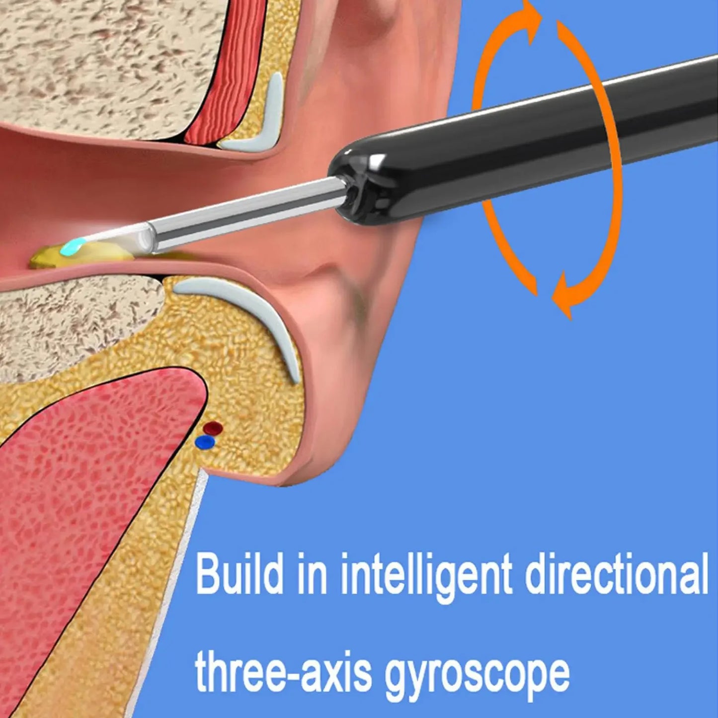 Otoscope Ear Wax Removal