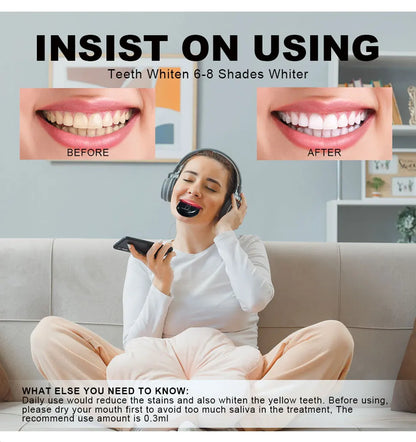 Teeth Whitening Led Light