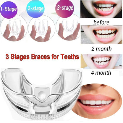 Teeth Retainer Mouth Guard