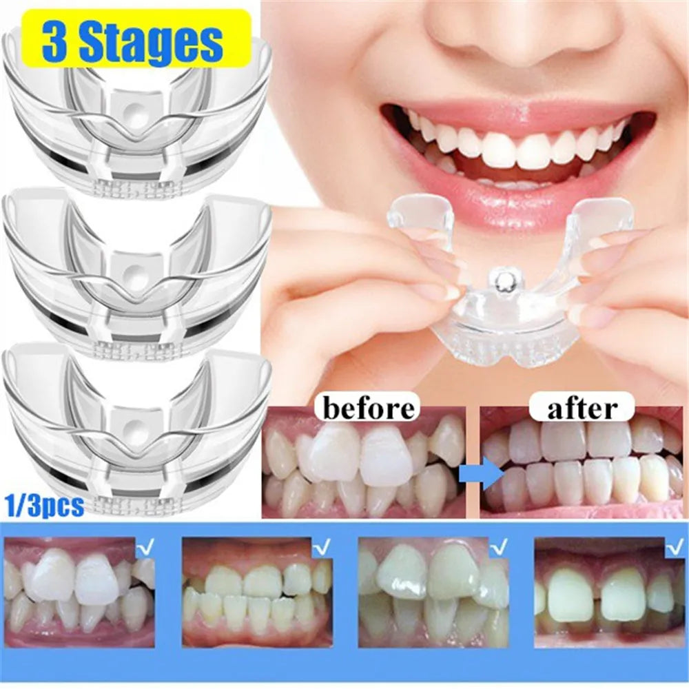 Teeth Retainer Mouth Guard